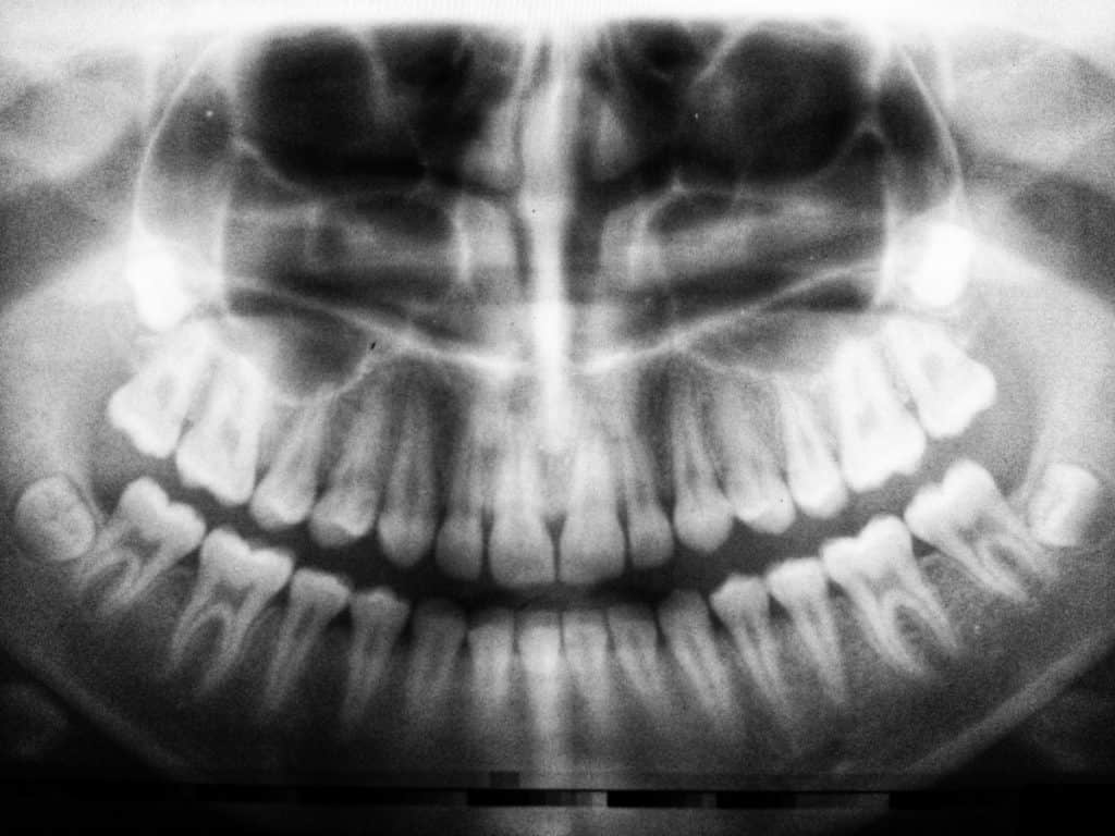 Are Humans Frugivores? Are We Designed to Eat Mostly Fruit? - I Am ...